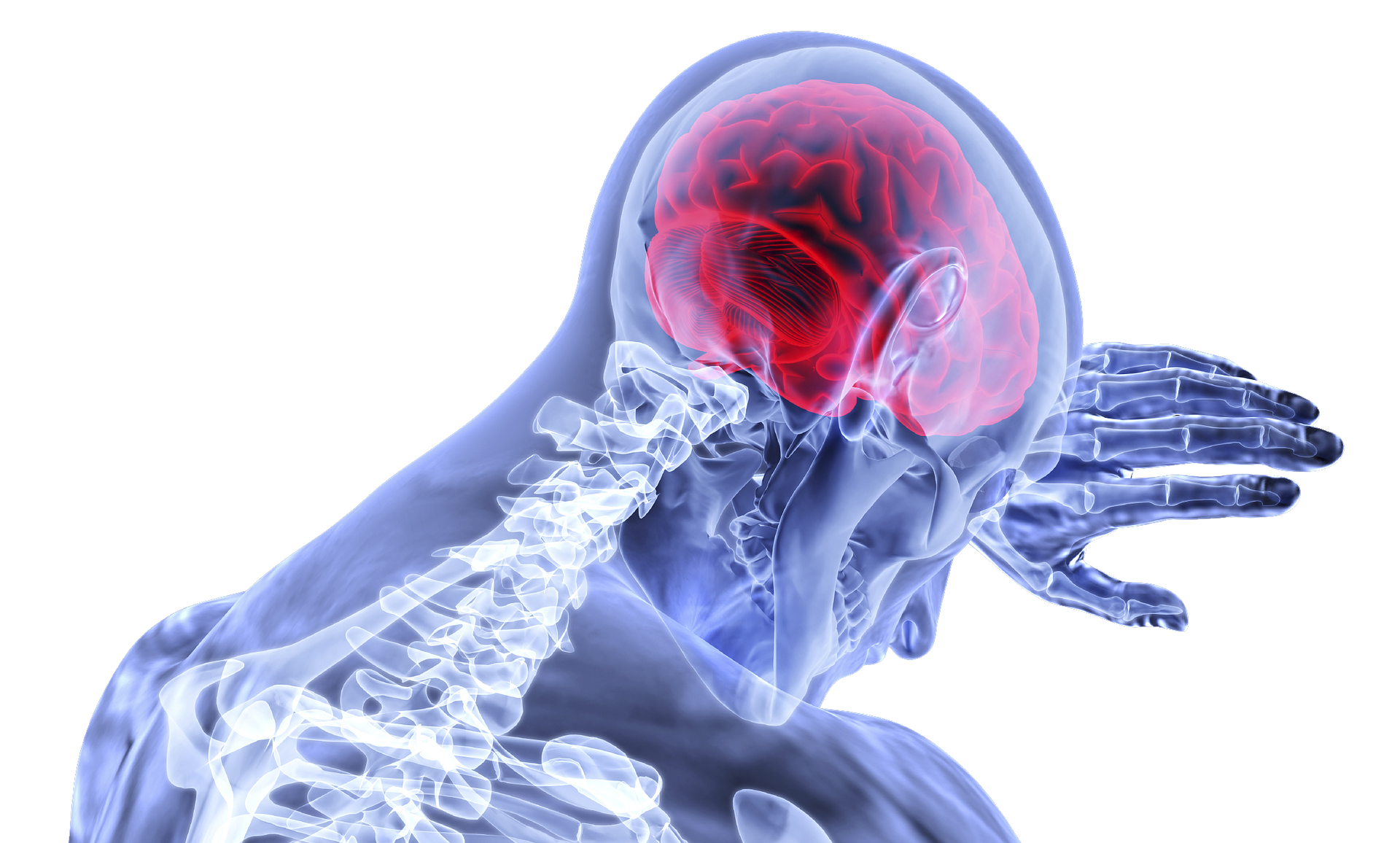 What is a Post-Concussion Syndrome and How do I Know if I Have it?